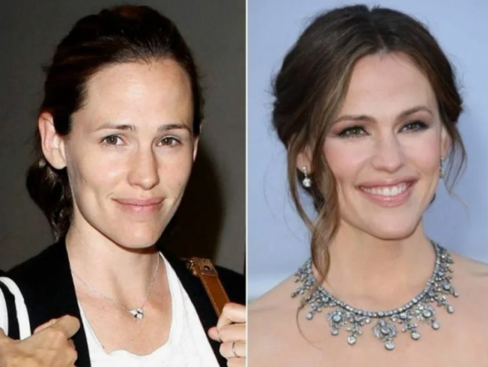 «Она не боится быть собой»: почему звезды отказываются от грима и как они выглядят без него?