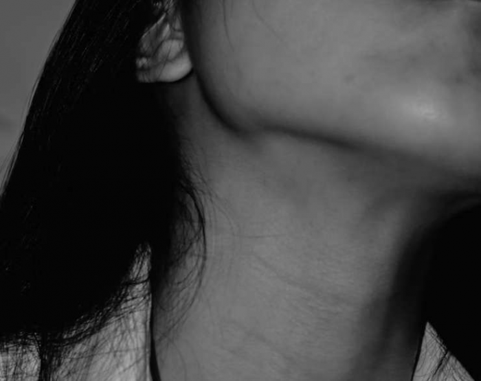 А по шее: уход за этой частью тела в холодное время года, 5 неочевидных правил