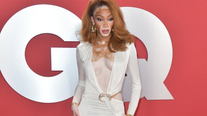 Модель с заболеванием кожи вышла в свет в платье с декольте до пупка